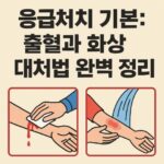 응급처치 뜻 - 화상-출혈-처치방법-완벽정리-썸네일